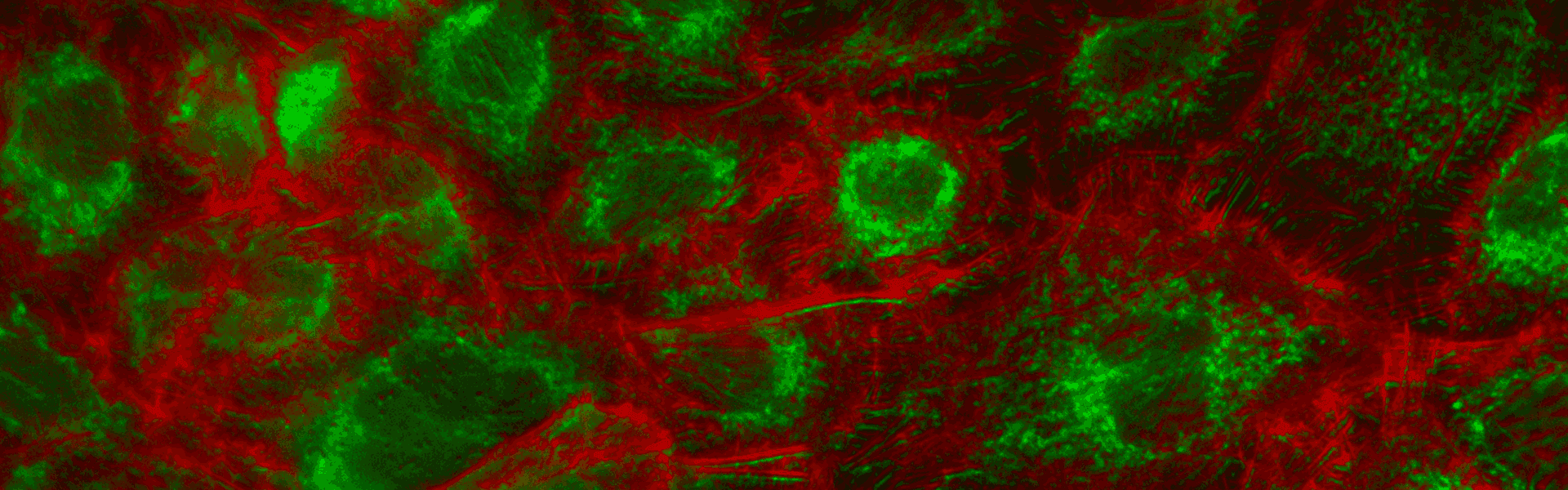 Beam shaper for fluorescence microscopy