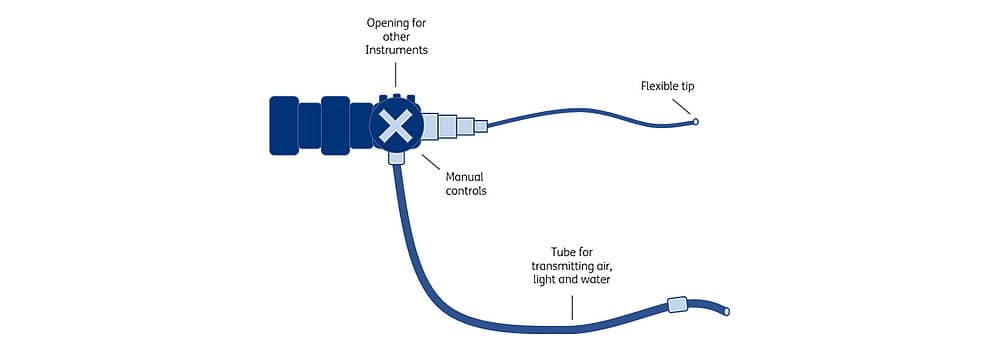 General schematic structure of an endoscope