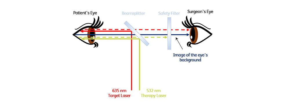 Figure: Schematic operation principle of a laser protection filter
